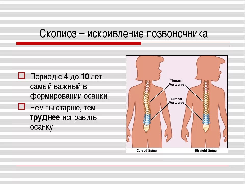 Сколиоз 2 степени это. Сколиотическая осанка. Степени искривления сколиоза. Сколиотическая деформация позвоночника. Презентация на тему сколиоз.