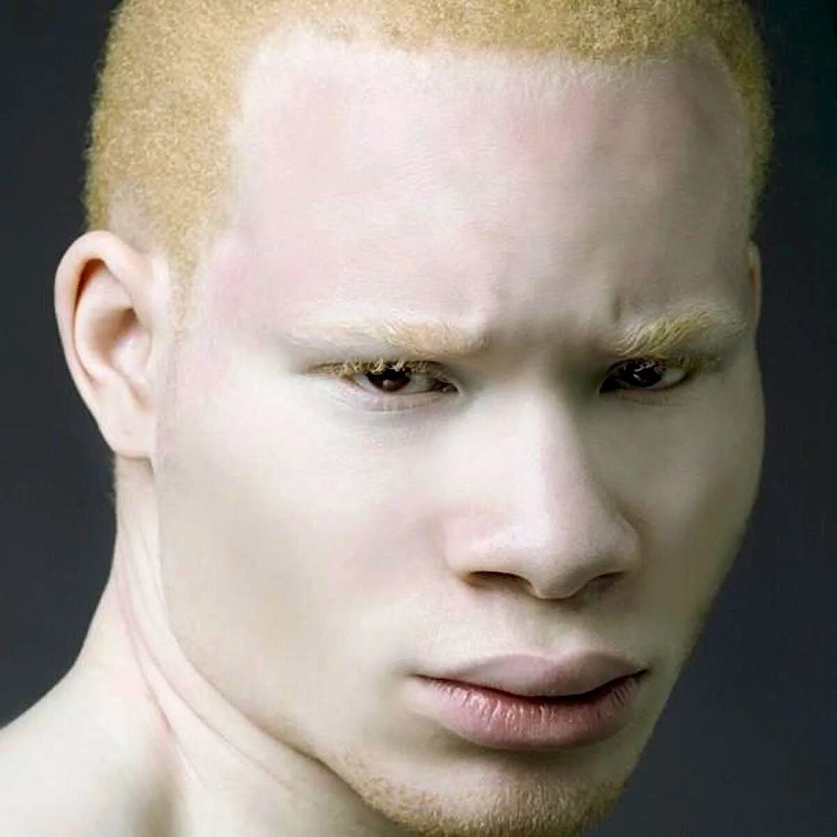 Что самое белое в черных людях. Актер Квентин альбинос. Афроазиат альбинос. Саша Смирнов альбинос.