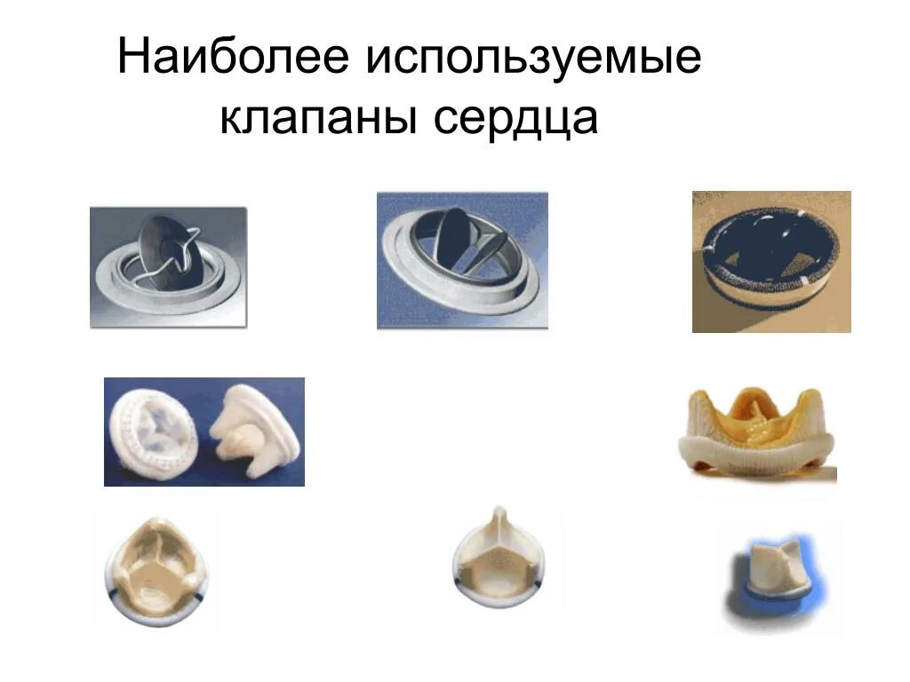 Применяется наиболее