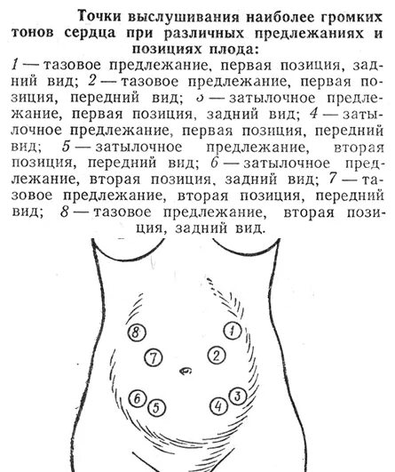 Можно почувствовать сердцебиение плода. Точки выслушивания сердцебиения плода. Точки аускультации сердцебиения плода. Выслушивание сердцебиения плода алгоритм. Точки выслушивания сердцебиения плода алгоритм.