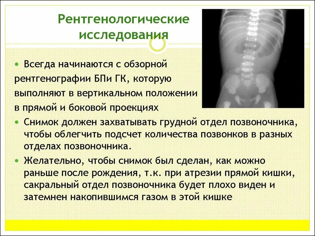 Выпадение прямой кишки причины. Рентгенологическое исследование. Области рентгенологического исследования. Рентгенологические исследования в вертикальном положении. Рентгенологическое исследование ребенка.