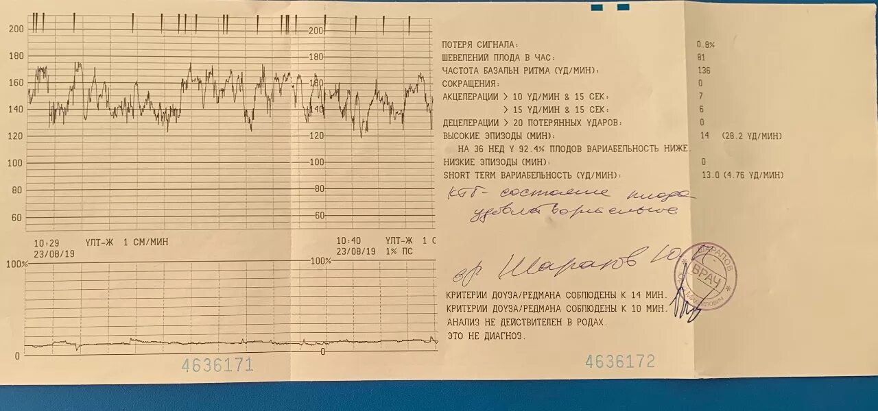 Шевеления на 33 неделе