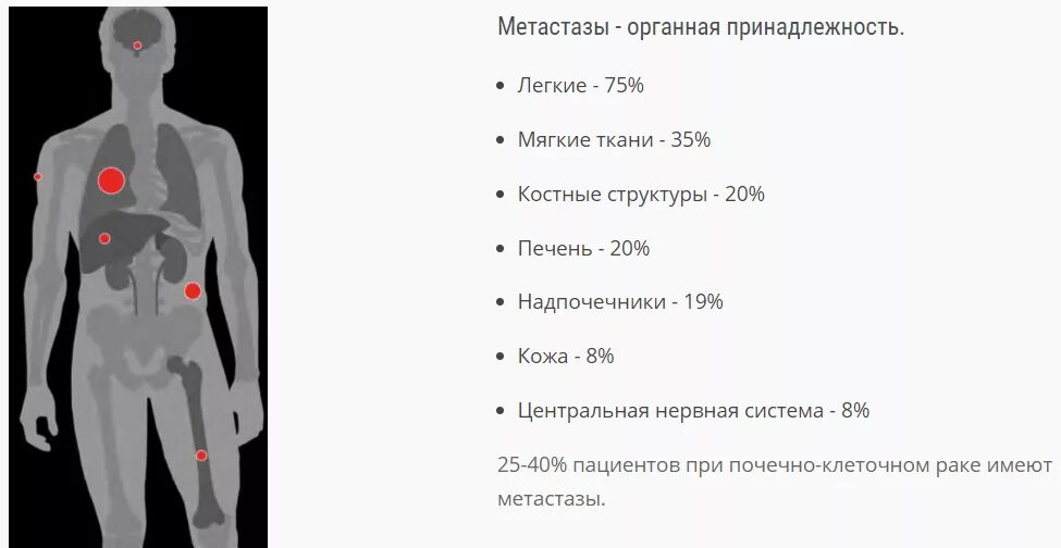 Какой рак метастазирует. Метастазирование опухоли почки. Локализация отдаленных метастазов. Отдаленные метастазы легких. Органы мишени при метастазах.