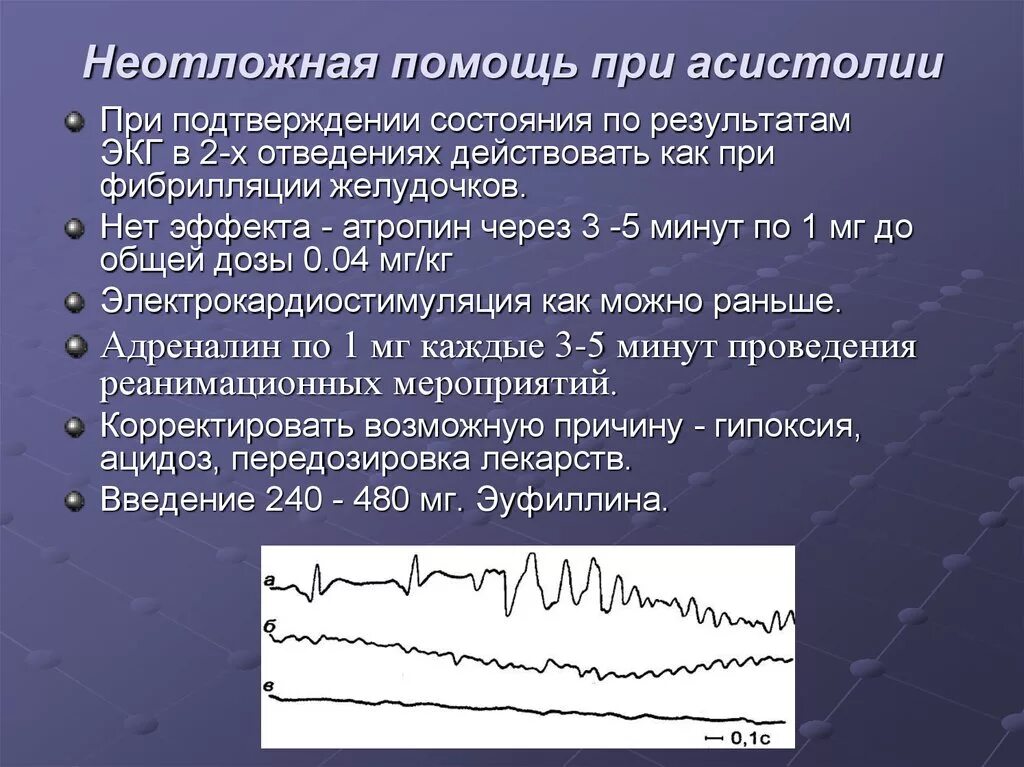 Асистолия сердца это. Фибрилляция желудочков сердца на ЭКГ. Алгоритм неотложной помощи при фибрилляции желудочков. Асистолия и фибрилляция желудочков. Фибрилляция желудочков на ЭКГ.