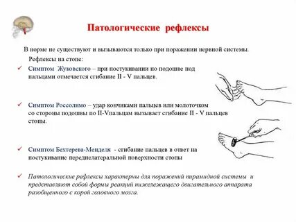 Рефлексы после инсульта