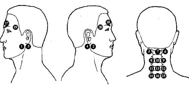 Точки на затылке. Точки на шее для массажа. Точечный массаж черепа. Массажные точки на затылке.