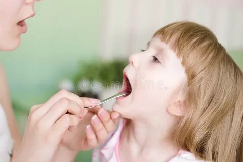 Какой аллергия горло