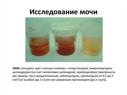 Мочеиспускание красного цвета