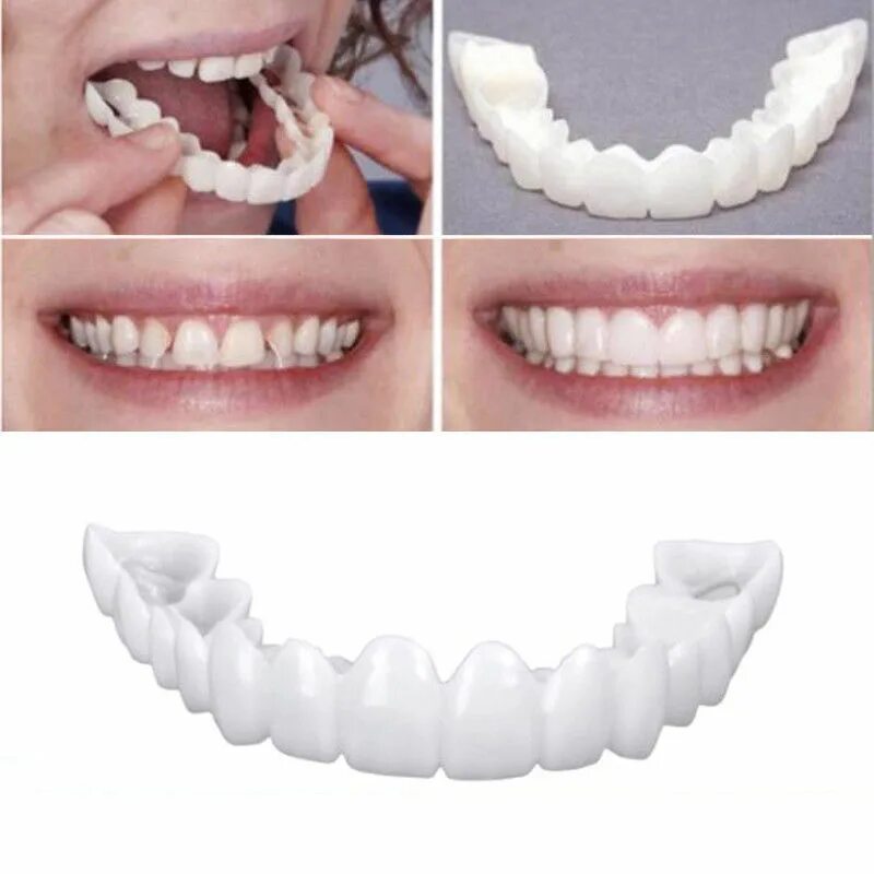 Сколько стоят виниры. Виниры Snap on smile. Виниры-элайнеры Snap-on smile. Cъемные виниры perfect smile Veneer (Snap on smile). Элайнеры Snap on smile.