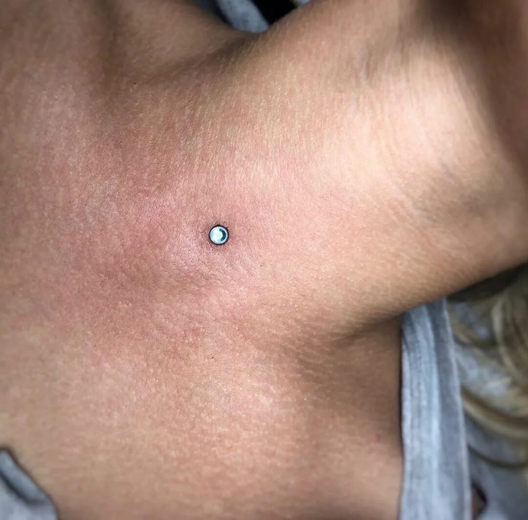 Микродермал лунный камень. Микродермал воспалился. Микродермал зеленоград. Микродермал украшение. Голубой микродермал на шее.