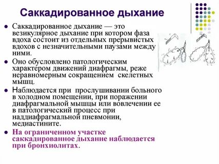 Саккадированное дыхание это
