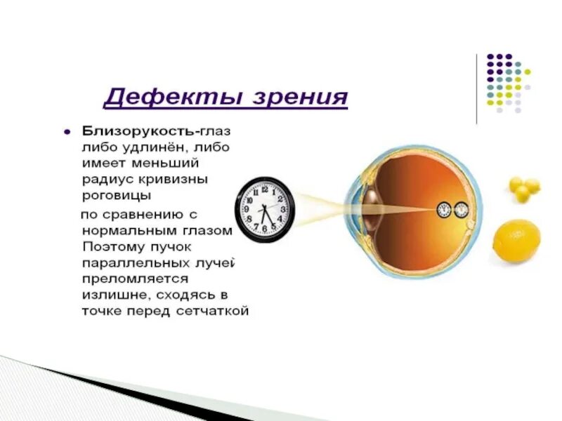 Структура дефекта при нарушениях зрения. Первичный дефект нарушения зрения. структура дефекта нарушения зрения. структура дефекта при нарушении зрения. первичные и вторичные нарушения зрения.