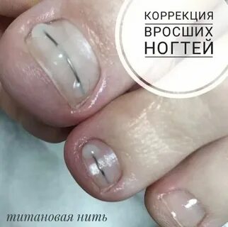 Титановая нить