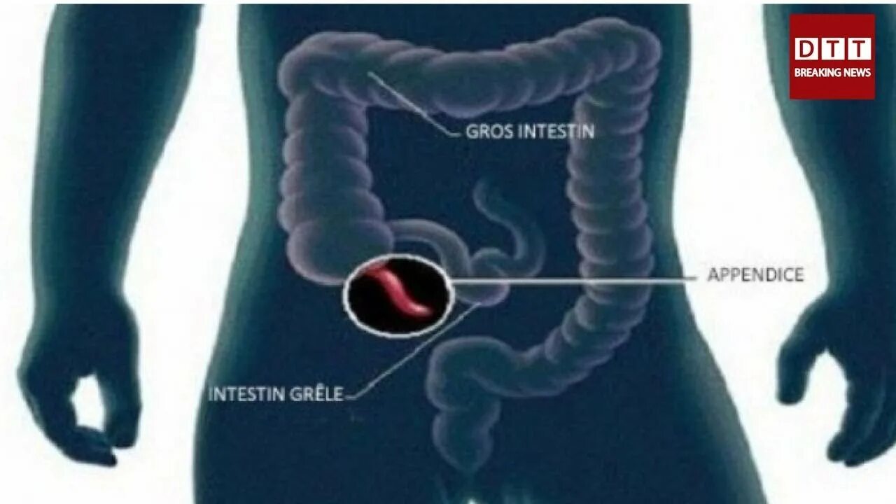 Аппендикс в теле человека. Толстая кишка аппендикс
