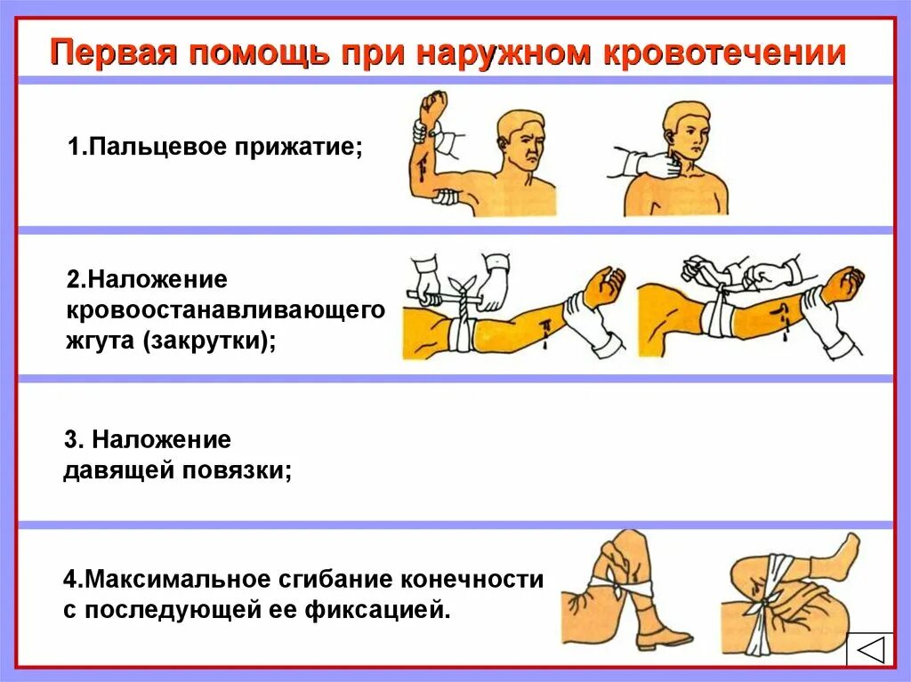 Первая помощь при кровотечениях 8 класс обж. Этапы оказания первой помощи при наружных кровотечениях. Последовательность оказания первой помощи при наружном кровотечении. Последовательность этапов 1 помощи при наружном кровотечении. Последовательные этапы 1 помощи при наружном кровотечении.