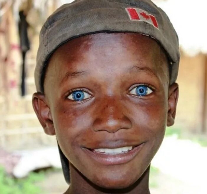 Глаза чернокожих. Дети с необычными глазами. Люди со светлыми глазами. Негр с голубыми глазами. Необычные глаза у людей.