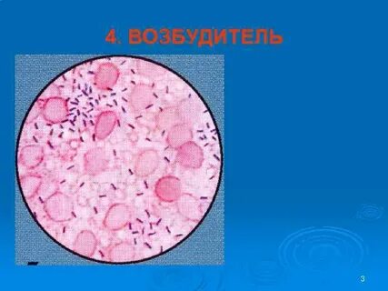 Возбудитель рожи