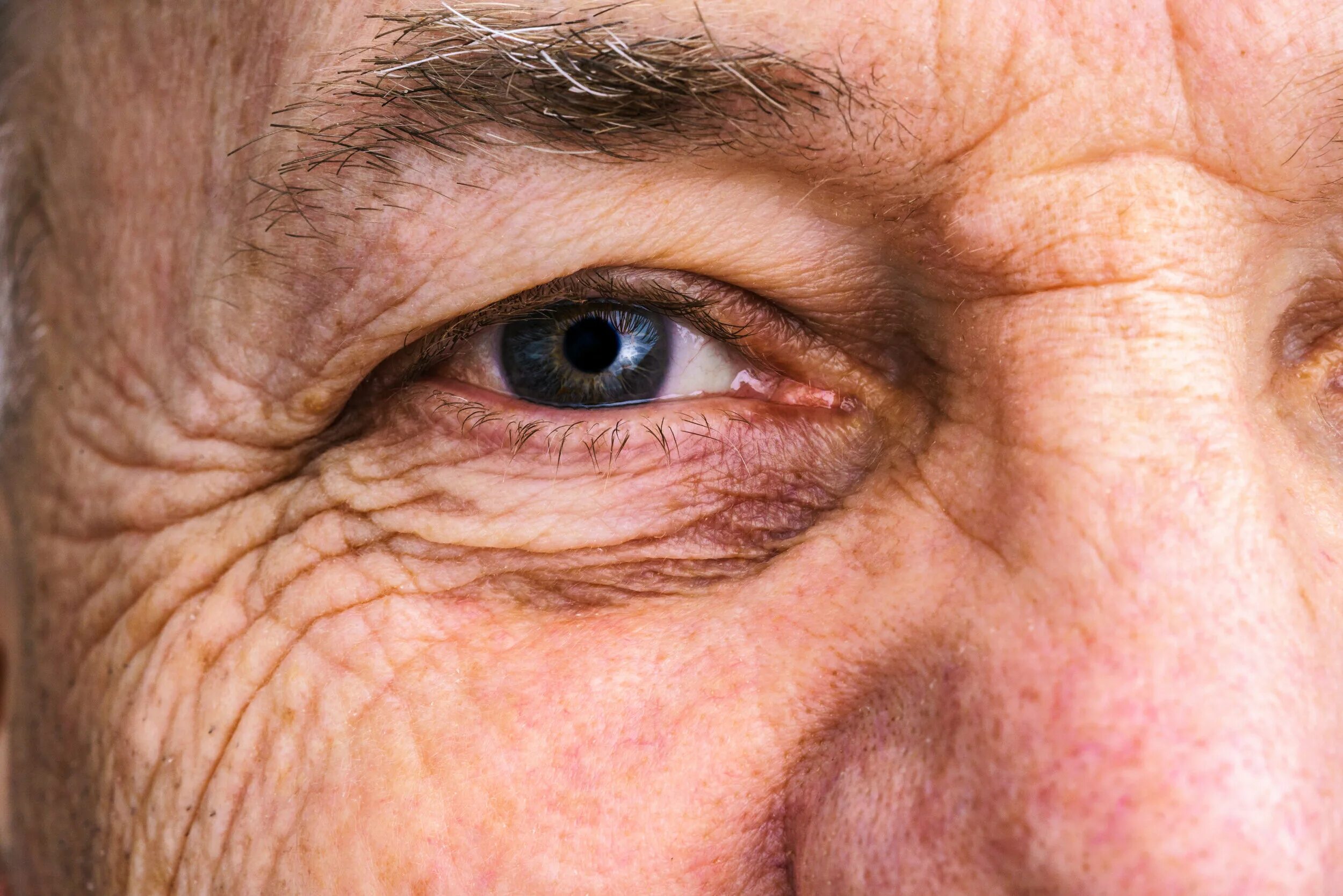 Старые глазки. Глаза пожилого человека. Заболевания глаз в пожилом возрасте.
