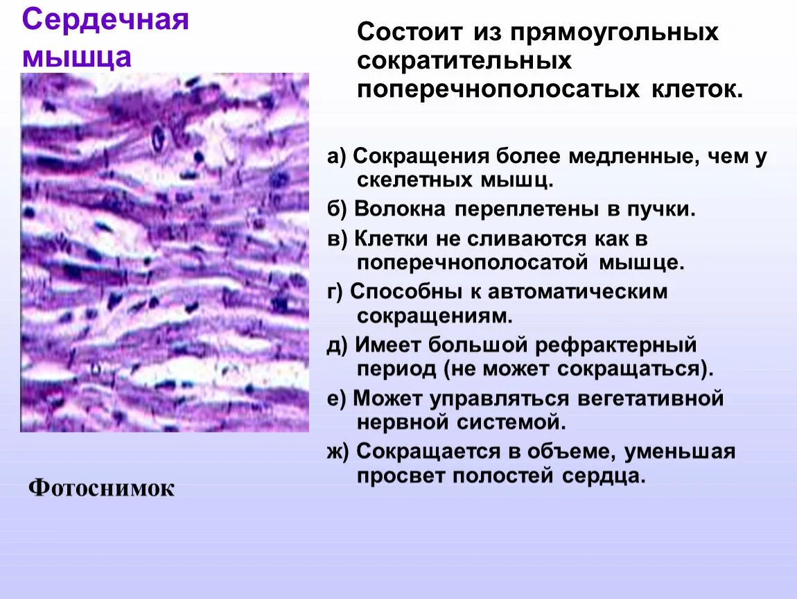 Поперечнополосатая мышечная ткань сердца. Клетки сателлиты это в мышечной ткани. Миосателлитоциты в мышечной ткани. . Поперечнополосатая Скелетная мышечная ткань клетки. Поперечнополосатая сердечная ткань.