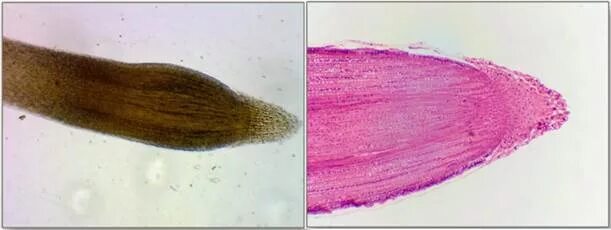 Root Tip: Root Apical Meristem, Protoderm, Procambium, Ground Meristem Biology, 