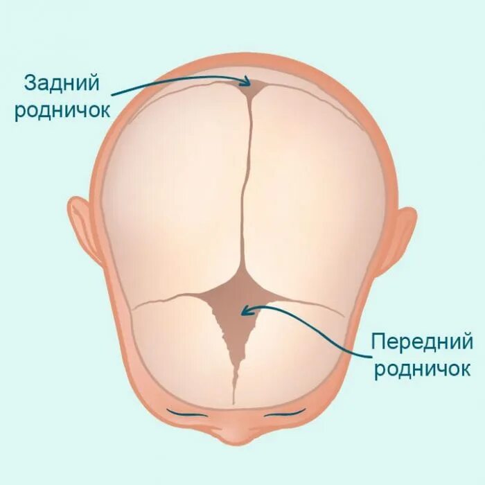 В месяц зарос родничок. Малый Родничок у новорожденных расположен. Передний Родничок черепа новорожденного. Большой и малый роднички у новорожденных.