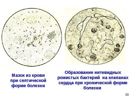 Возбудитель рожи