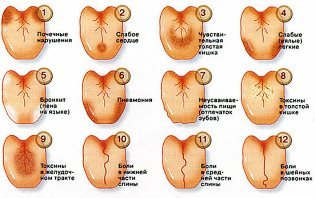 Что означают трещины. Желучный налет на языке.