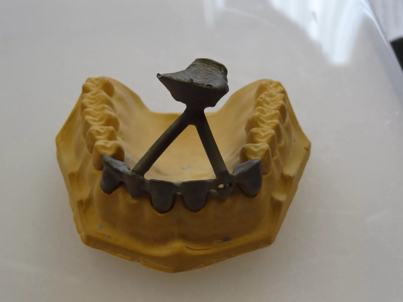 Литье протезов. Литье в стоматологии. Литье в стоматологии. Литье в стоматологии ортопедической. Литниковая система коронки.