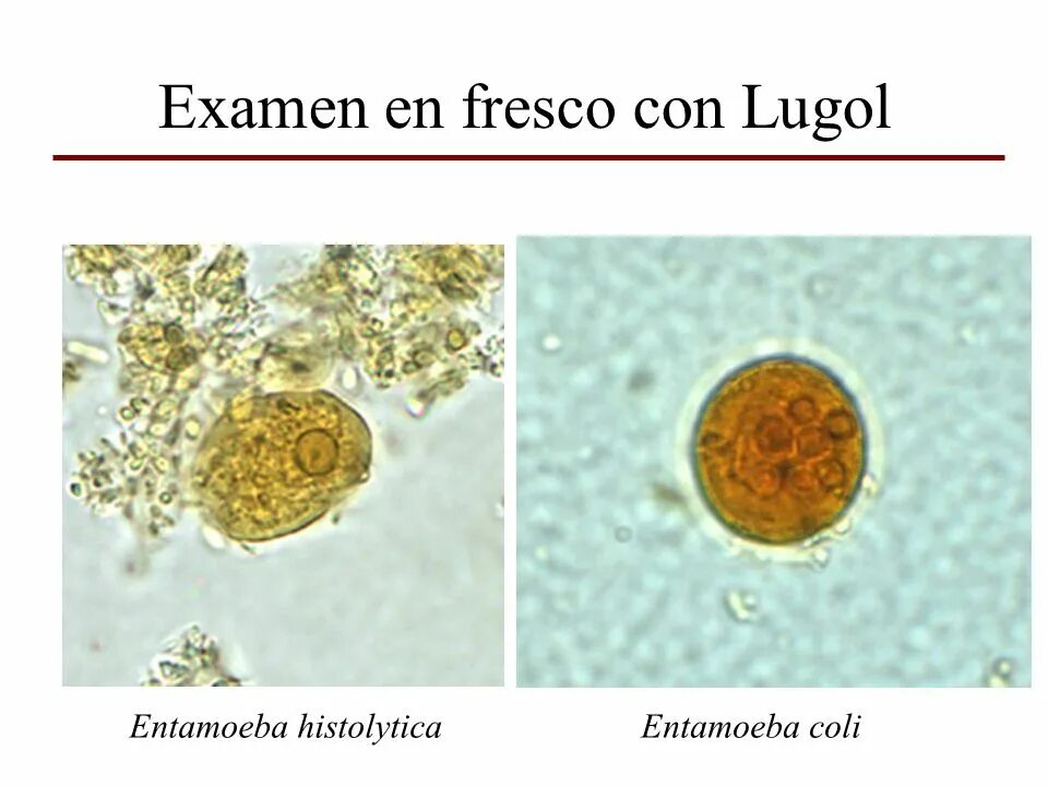 Entamoeba coli в кале. Entamoeba histolytica циста. Entamoeba histolytica под микроскопом. Цисты Entamoeba. Entamoeba coli циста.