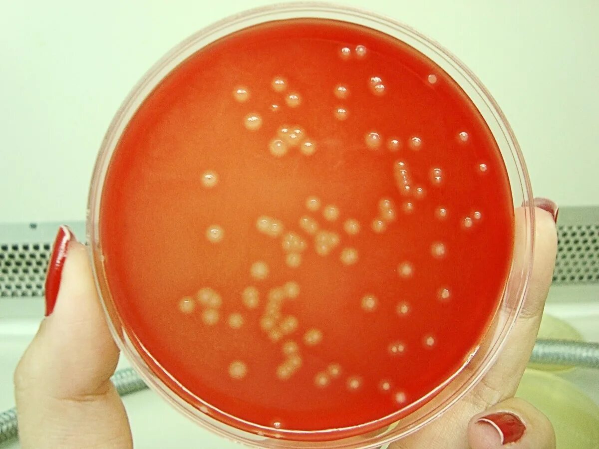 Streptococcus. Стрептококк агалактия. гноеродный стрептококк. streptococcus agalactiae микробиология. β-гемолитический стрептококк.