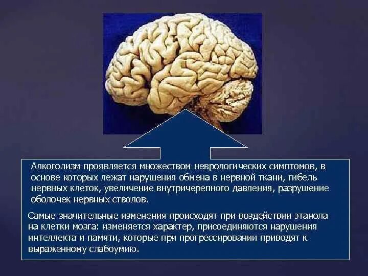 В чем выражается много