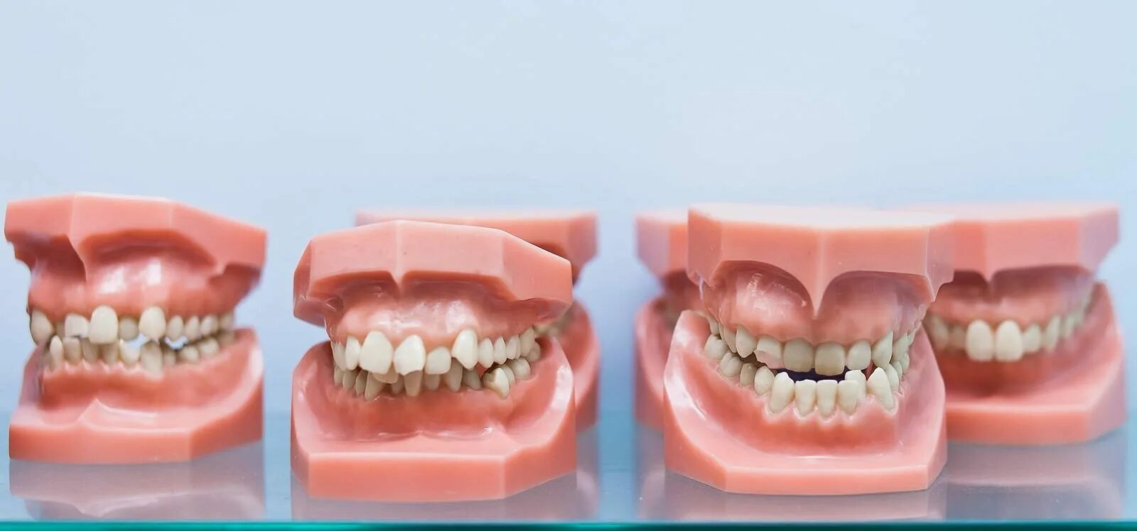 Зубы при закрытом рте. Дистальный прикус челюсти. Дистальный прикус с ровными зубами. Правильный прикус челюсти. Правильный и неправильный прикус.