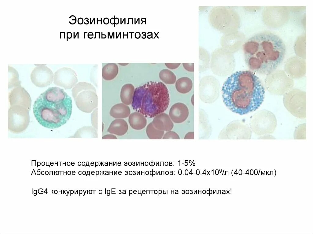 Эозинофилы 0 4