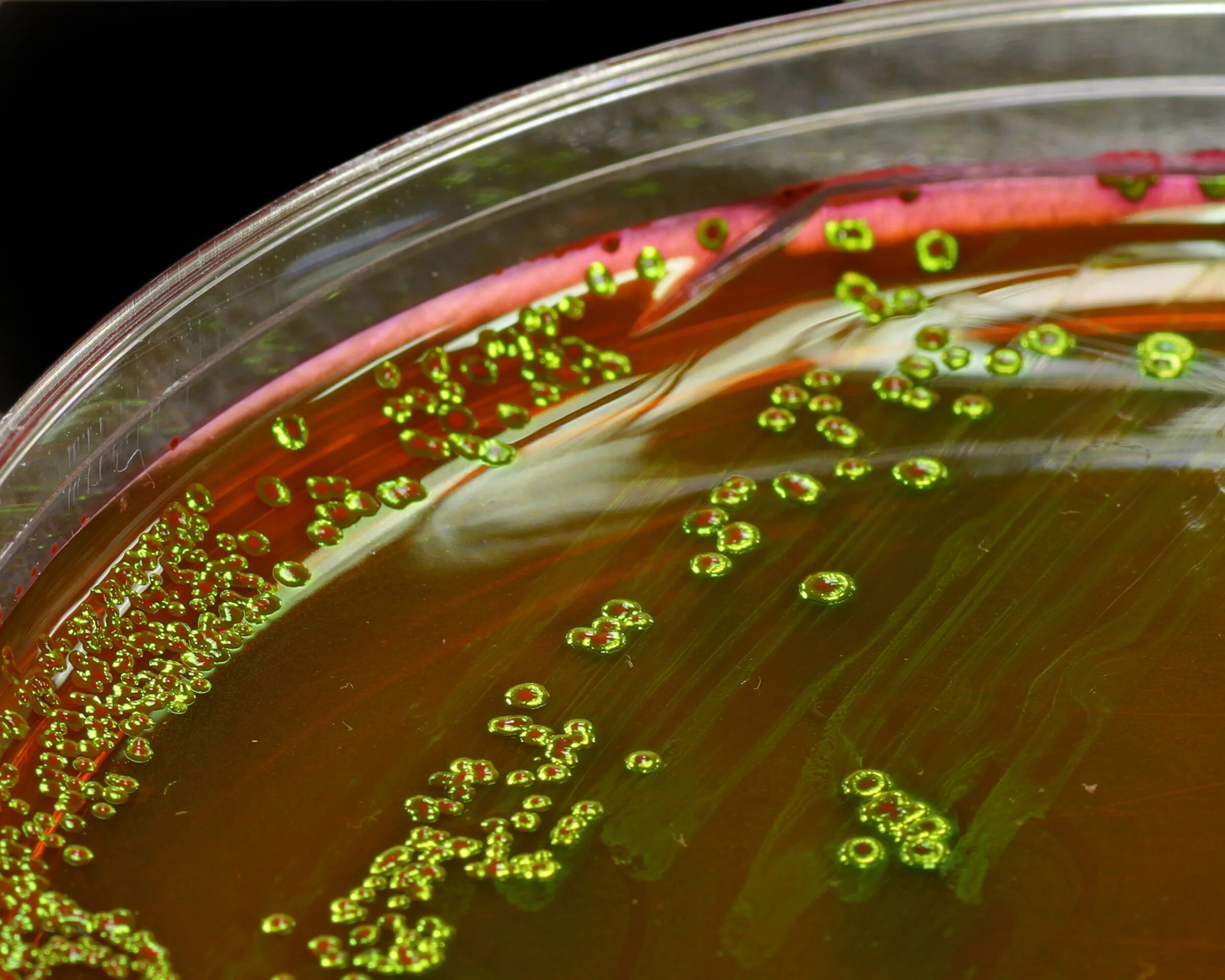 Бактерии в жидкой среде. Pseudomonas aeruginosa мясопептонный бульон. Pseudomonas aeruginosa на чашке Петри. Кишечная палочка на Эндо. Мясопептонный агар эшерихии.