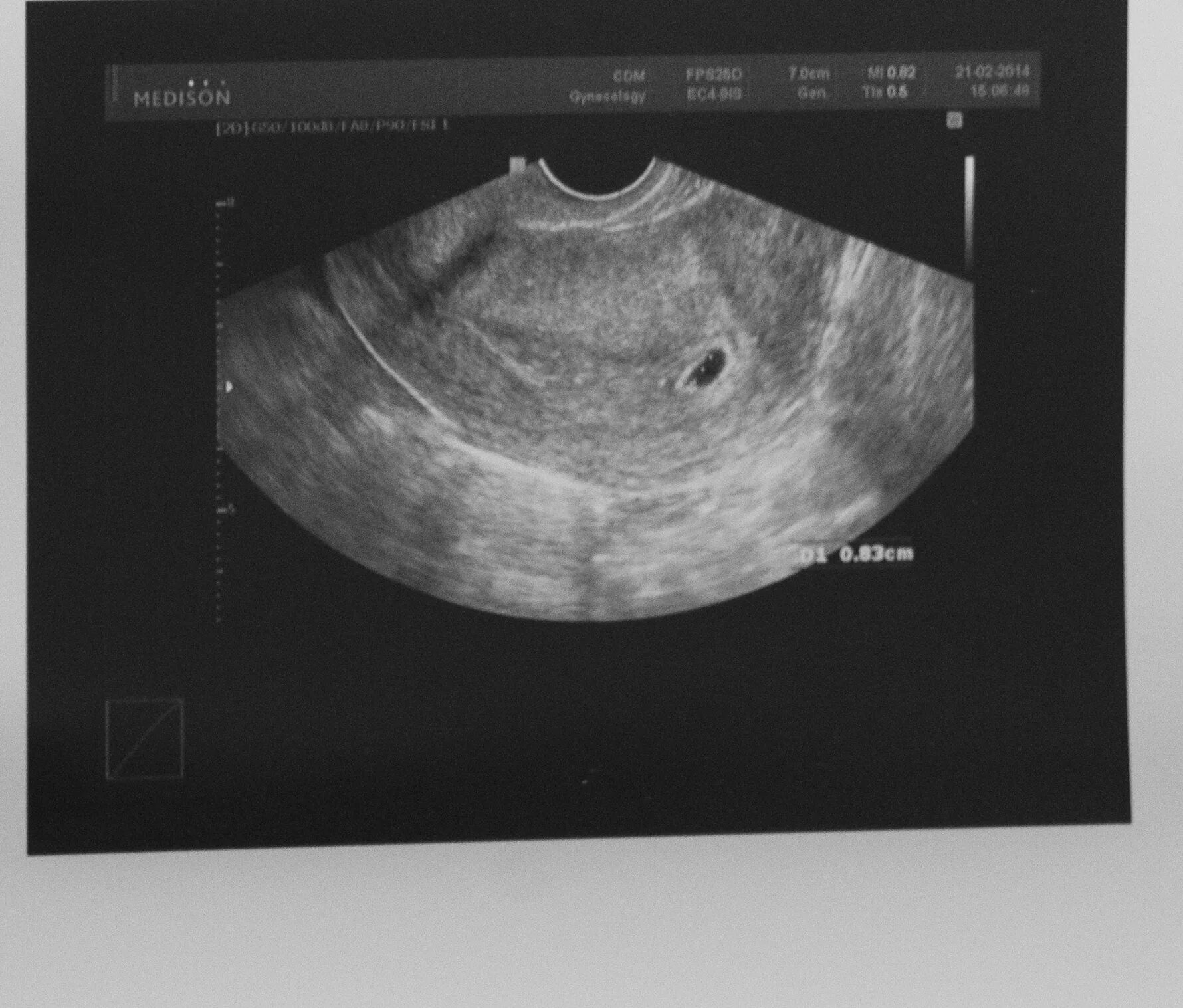 через 5 недель ваши