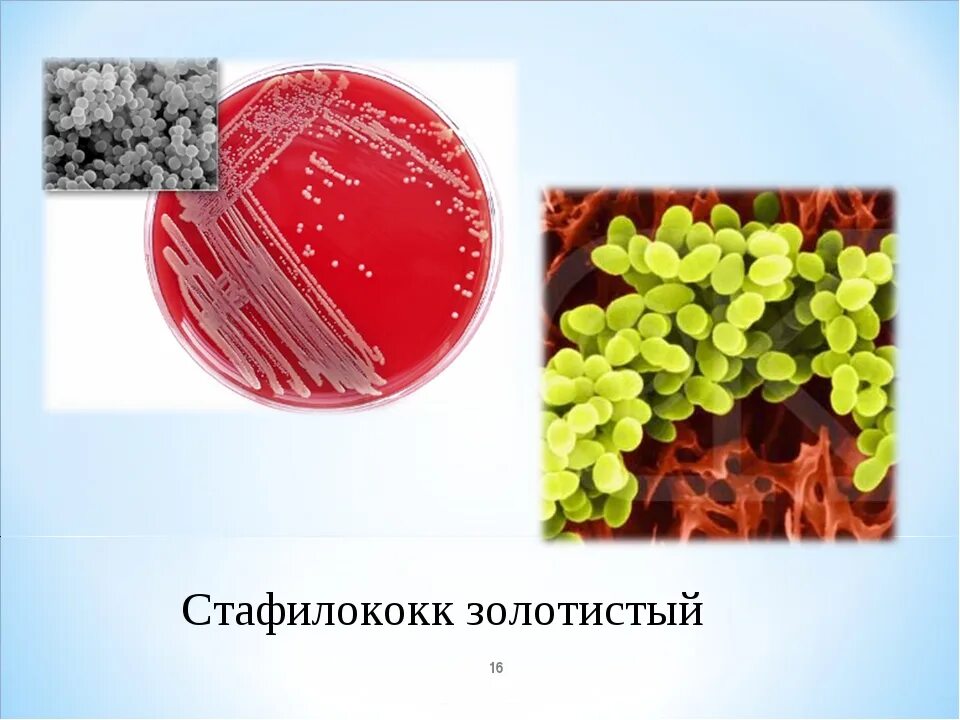 Золотистый стафилококк 5 степени. S. aureus золотистый стафилококк. золотистый стафилококк анаэроб. золотистый стафилококк рисунок микробиология. зеленящий стафилококк.