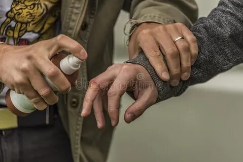 Получил травму руки
