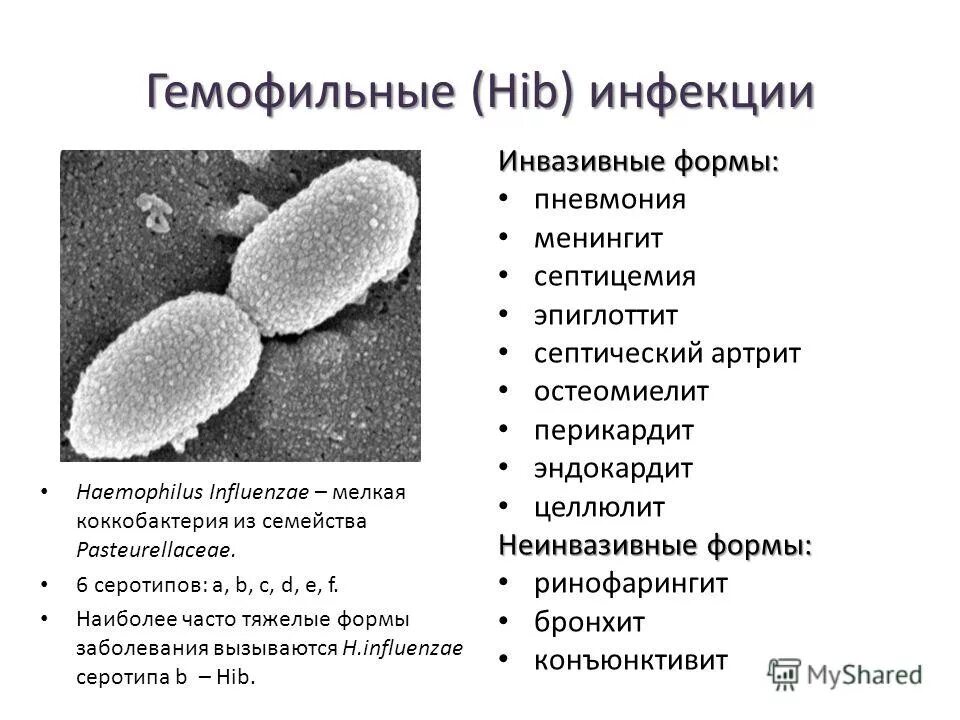 Haemophilus influenzae 10