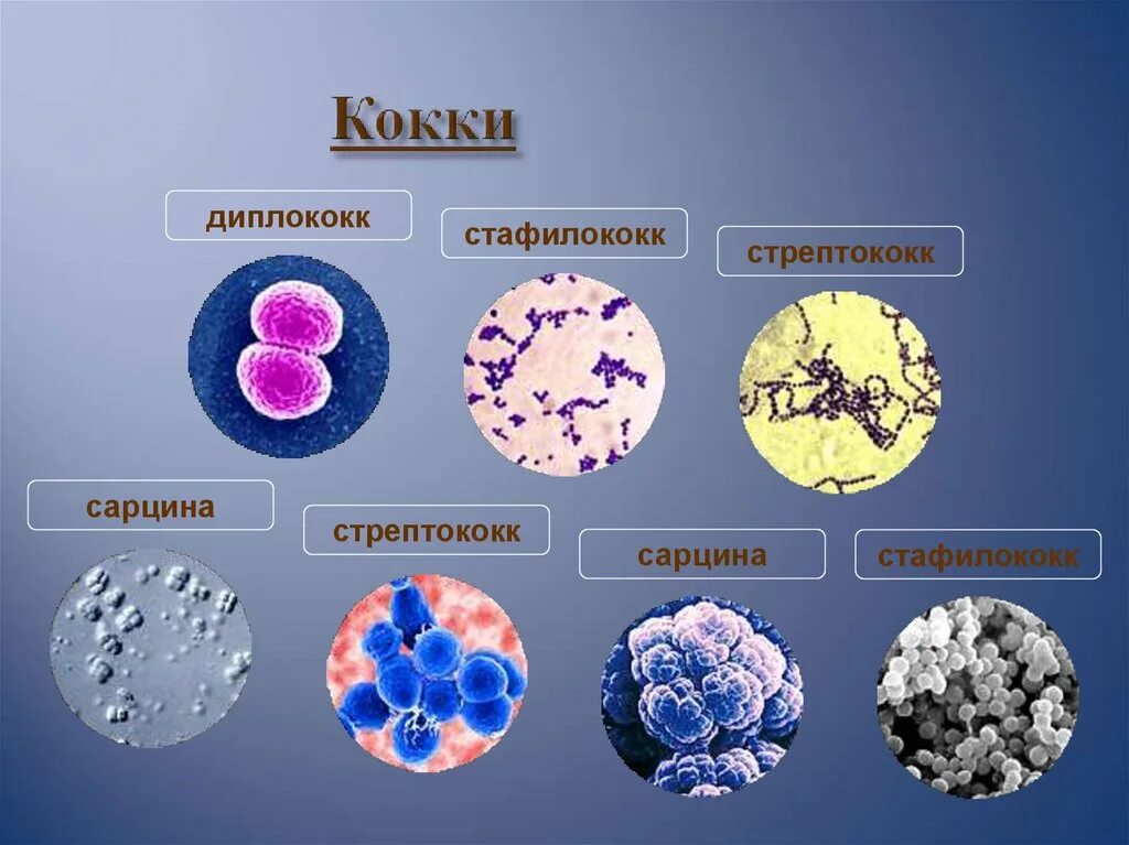 Большим количеством кокки