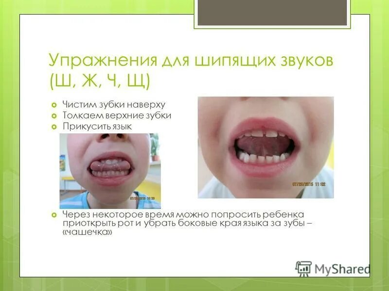 Ставить ш