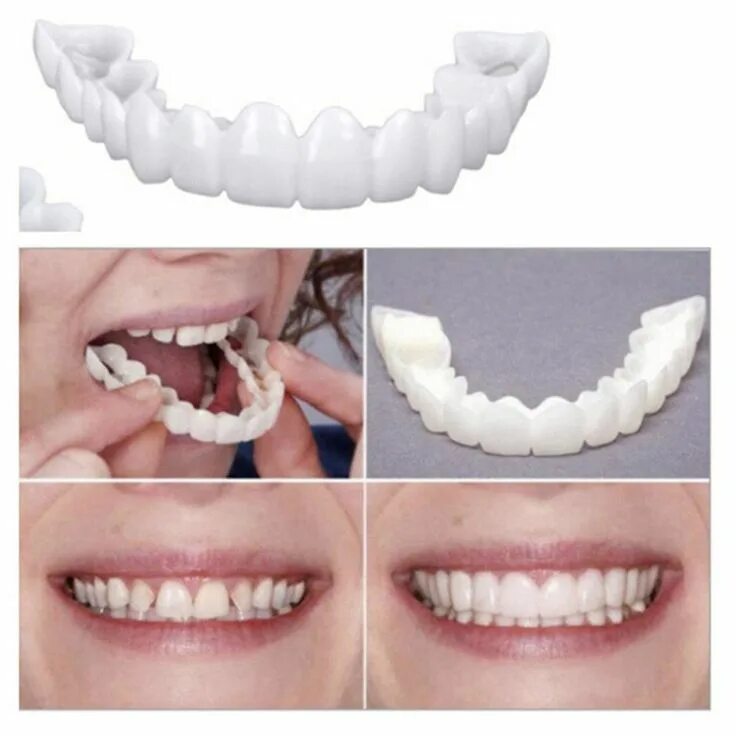 Готовы зубы. Виниры комплект snap-on smile. виниры trusmile. накладки на зубы съемные.