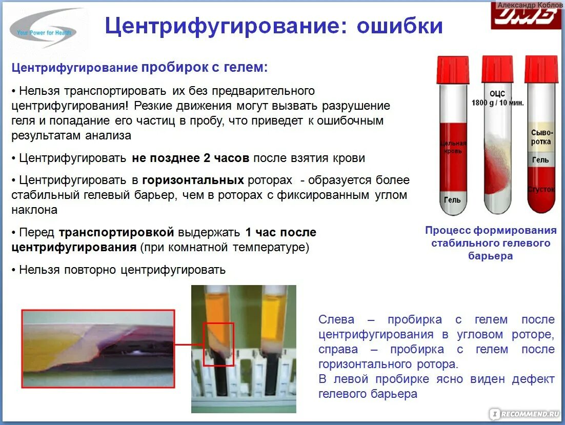 Почему сворачивается кровь из вены. Сыворотка крови в пробирке после центрифугирования. Пробирки с сывороткой крови центрифугируют. Пробирки для взятия венозной крови. Пробирки для забора крови на общий анализ.