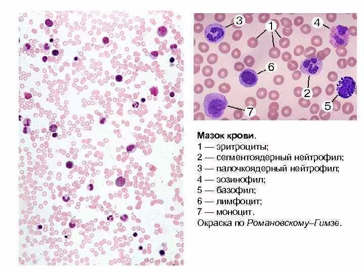 Мазок крови при выявлении патологии что это. Лейкоциты мазок крови человека гистология. Мазок крови ЧЕЛОВЕКАОКРАСКА нематоксилин эозин. Препарат мазка крови гистология. Форменные элементы крови гистология.