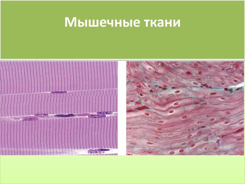 Скелетная мускулатура гистология. Скелетная мышечная ткань гистология. Поперечнополосатая мышца гистология. Поперечнополосатая Скелетная мышечная ткань гистология. Препарат поперечно полосатая мышечная ткань