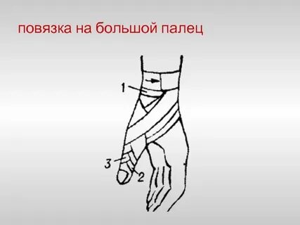 Повязка на большой палец