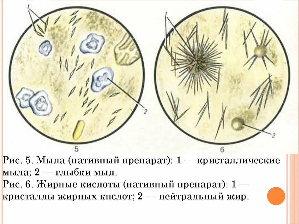 Нейтральный жир в копрограмме. Микроскопия кала нейтральный жир. Нейтральный жир в копрограмме. Копрограмма норма у детей таблица. Нейтральный жир в копрограмме.