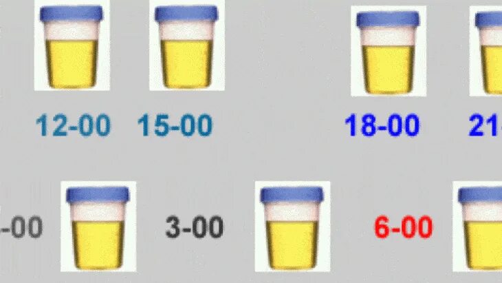 Сколько нужно мочи для анализа. Минимальный объем мочи для анализа. Сколько нужно мочи для сдачи анализов. Сколько мл мочи надо для анализа. Сколько надо мочить