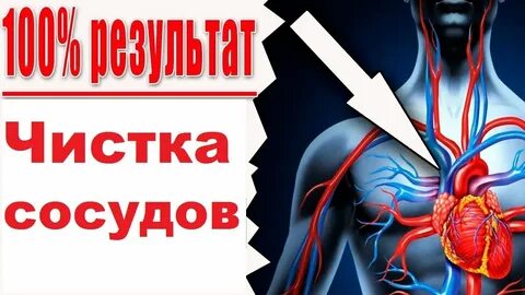 Неумывакин сосуды