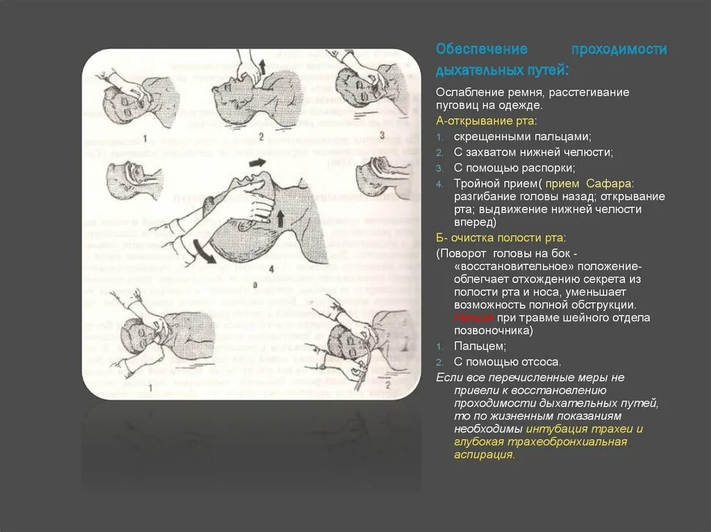 Обеспечение проходимости ВДП. Какими способами обеспечить проходимость верхних дыхательных путей. Оборудование для обеспечения проходимости дыхательных путей. Приемы обеспечивающие проходимость верхних дыхательных путей. Проверка проходимости дыхательных путей
