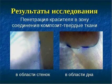 Состояние зона